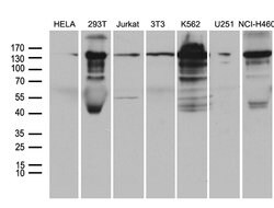 SMC1A Monoclonal Antibody (OTI5A1), TrueMAB , OriGene 100 &mu;L; Unconjugated:Antibodies,