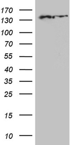 SMC1A Monoclonal Antibody (OTI6C5), TrueMAB , OriGene:Antibodies:Primary