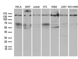 SMC1A Monoclonal Antibody (OTI6C5), TrueMAB , OriGene:Antibodies:Primary