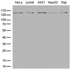 SMC1A Monoclonal Antibody (OTI5C8), TrueMAB , OriGene:Antibodies:Primary