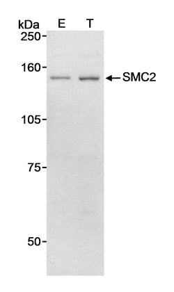 SMC2 Rabbit anti-Human, Polyclonal, Bethyl Laboratories 100 &mu;L; Unconjugated:Antibodies,