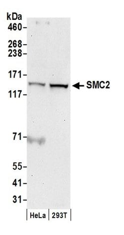 SMC2 Polyclonal Antibody, Bethyl Laboratories 20 &mu;L; Unconjugated:Antibodies,