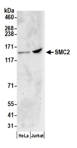 SMC2 Rabbit anti-Human, Polyclonal, Bethyl Laboratories 100 &mu;L; Unconjugated:Antibodies,