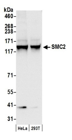 SMC2 Rabbit anti-Human, Polyclonal, Bethyl Laboratories 100 &mu;L; Unconjugated:Antibodies,