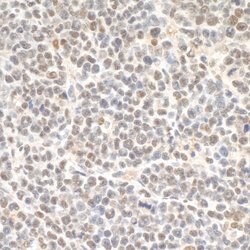 SMC3 Rabbit anti-Human, Mouse, Polyclonal, Bethyl Laboratories 100 &mu;L;