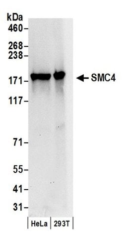 SMC4 Polyclonal Antibody, Bethyl Laboratories:Antibodies:Primary Antibodies