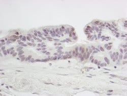 SMC6 Polyclonal Antibody, Bethyl Laboratories 100 &mu;L | Buy Online | Bethyl Laboratories, Inc | Fisher Scientific