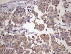 SMCP Monoclonal Antibody (OTI6G9), TrueMAB , OriGene 100 &mu;L; Unconjugated:Antibodies,