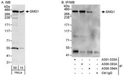 SMG1 Rabbit anti-Human, Polyclonal, Bethyl Laboratories 100 &mu;L; Unconjugated:Antibodies,