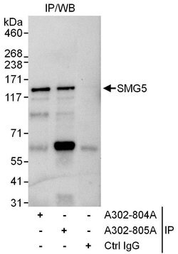 SMG5 Rabbit anti-Human, Polyclonal, Bethyl Laboratories 10 &mu;L; Unconjugated:Antibodies,