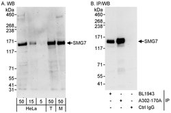 SMG7 Rabbit anti-Human, Mouse, Polyclonal, Bethyl Laboratories 100 &mu;L;