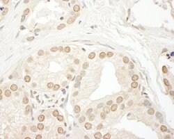 SMG9 Rabbit anti-Human, Polyclonal, Bethyl Laboratories 10 &mu;L; Unconjugated:Antibodies,