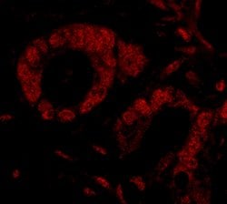 SMG9 Polyclonal Antibody, Bethyl Laboratories 10 &mu;L; Unconjugated:Antibodies,