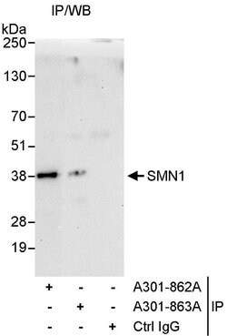 SMN1 Rabbit anti-Human, Polyclonal, Bethyl Laboratories 10 &mu;L; Unconjugated:Antibodies,