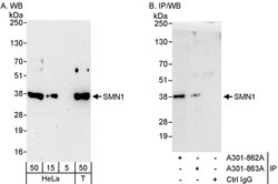 SMN1 Rabbit anti-Human, Polyclonal, Bethyl Laboratories 100 &mu;L; Unconjugated:Antibodies,