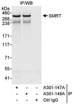 SMRT Rabbit anti-Human, Polyclonal, Bethyl Laboratories 10 &mu;L; Unconjugated:Antibodies,