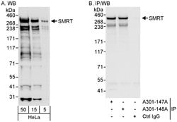 SMRT Rabbit anti-Human, Polyclonal, Bethyl Laboratories 100 &mu;L; Unconjugated:Antibodies,