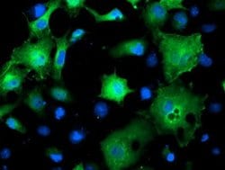 SMS Monoclonal Antibody (OTI5F2), TrueMAB , OriGene 30 &mu;L; Unconjugated:Antibodies,