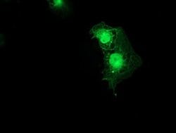 SMS Monoclonal Antibody (OTI2H1), TrueMAB , OriGene 30 &mu;L; Unconjugated:Antibodies,