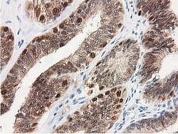 SMS Monoclonal Antibody (OTI2G8), TrueMAB , OriGene 100 &mu;L; Unconjugated:Antibodies,