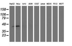 SMS Mouse anti-Human, Clone: OTI5E5, lyophilized, TrueMAB 100 &mu;g; Unconjugated:Antibodies,