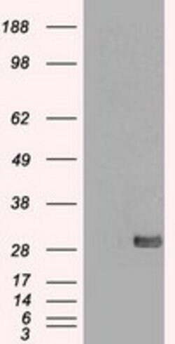 SNAI1 Mouse anti-Human, Clone: OTI10D7, lyophilized, TrueMAB 100 &mu;g;