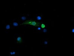 SNAI2 Mouse anti-Human, Clone: OTI2B12, lyophilized, TrueMAB 100 &mu;g;