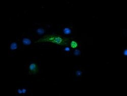 SNAI2 Monoclonal Antibody (OTI2B12), TrueMAB , OriGene 100 &mu;L; Unconjugated:Antibodies,