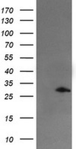 SNAI2 Monoclonal Antibody (OTI2B12), TrueMAB , OriGene 100 &mu;L; Unconjugated:Antibodies,