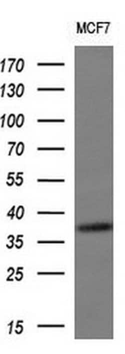 SNAI2 Monoclonal Antibody (OTI1H10), TrueMAB , OriGene 100 &mu;L; Unconjugated:Antibodies,