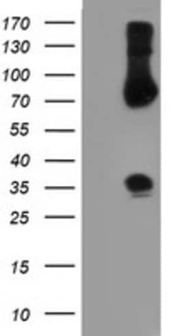 SNAI2 Mouse anti-Human, Clone: OTI2F3, lyophilized, TrueMAB 100 &mu;g;