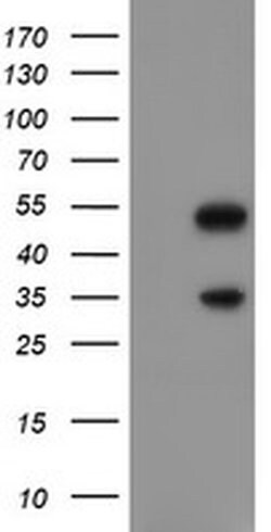 SNAI2 Mouse anti-Human, Clone: OTI1A6, liquid, TrueMAB 100 &mu;L; Unconjugated:Antibodies,