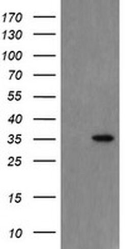 SNAI2 Monoclonal Antibody (OTI4B3), TrueMAB , OriGene:Antibodies:Primary