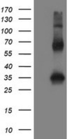 SNAI2 Mouse anti-Human, Clone: OTI1G7, lyophilized, TrueMAB 100 &mu;g;