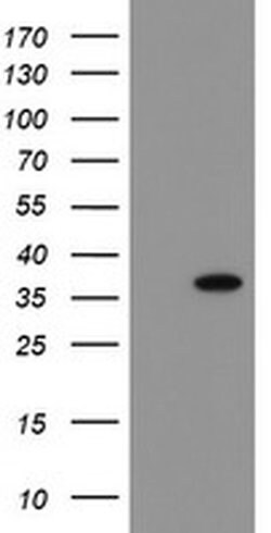 SNAI2 Monoclonal Antibody (OTI4E1), TrueMAB , OriGene 100 &mu;L; Unconjugated:Antibodies,