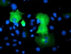 SNAP25 Mouse anti-Human, Clone: OTI4C6, lyophilized, TrueMAB 100 &mu;g;