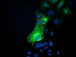 SNAP25 Monoclonal Antibody (OTI1G2), TrueMAB , OriGene:Antibodies:Primary