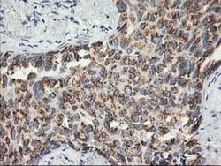 SNAP25 Monoclonal Antibody (OTI4B5), TrueMAB , OriGene 100 &mu;L; Unconjugated:Antibodies,