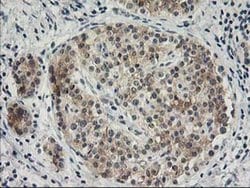 SNAP25 Monoclonal Antibody (OTI4B5), TrueMAB , OriGene 100 &mu;L; Unconjugated:Antibodies,