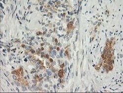 SNAP25 Monoclonal Antibody (OTI4B5), TrueMAB , OriGene 100 &mu;L; Unconjugated:Antibodies,