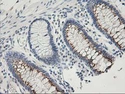 SNAP25 Monoclonal Antibody (OTI4B5), TrueMAB , OriGene 100 &mu;L; Unconjugated:Antibodies,