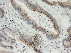 SNAP25 Monoclonal Antibody (OTI4B5), TrueMAB , OriGene 100 &mu;L; Unconjugated:Antibodies,