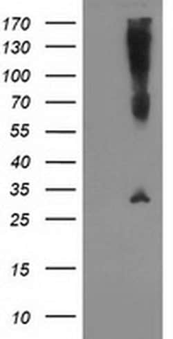 SNAP25 Monoclonal Antibody (OTI4C6), TrueMAB , OriGene:Antibodies:Primary