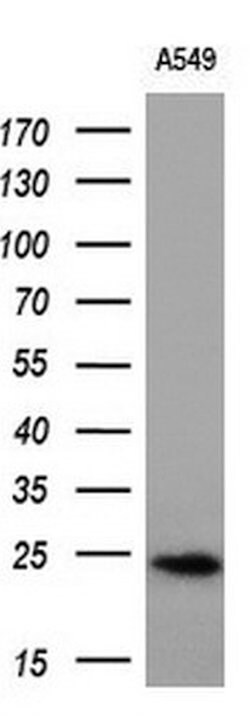 SNAP25 Mouse anti-Human, Clone: OTI4C6, lyophilized, TrueMAB 100 &mu;g;