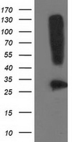 SNAP25 Monoclonal Antibody (OTI 1E6), TrueMAB , OriGene 30 &mu;L | Buy Online | OriGene | Fisher Scientific