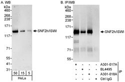 SNF2h/ISWI Rabbit anti-Human, Polyclonal, Bethyl Laboratories 100 &mu;l;