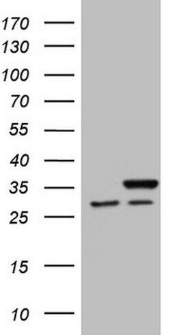 SNRPB2 Mouse anti-Human, Clone: OTI1B5, lyophilized, TrueMAB 100 &mu;g;