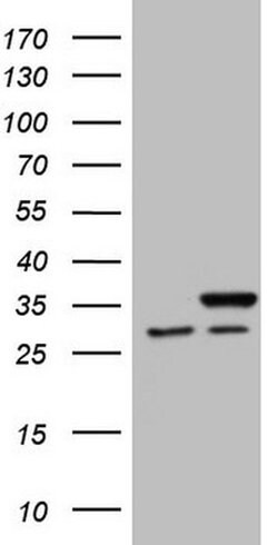 SNRPB2 Monoclonal Antibody (OTI1B5), TrueMAB , OriGene 100 &mu;L; Unconjugated:Antibodies,