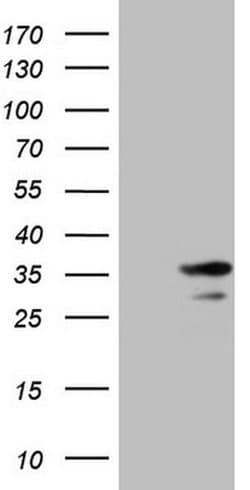 SNRPB2 Monoclonal Antibody (OTI2E8), TrueMAB , OriGene 100 &mu;L; Unconjugated:Antibodies,