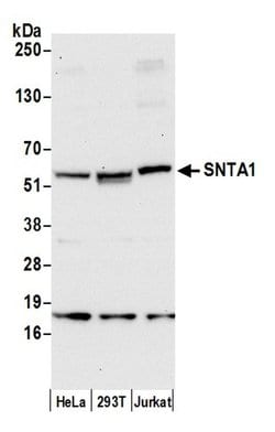 SNTA1 Polyclonal Antibody, Bethyl Laboratories 20 &mu;L; Unconjugated:Antibodies,